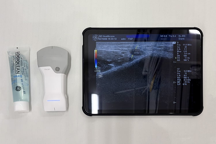皮膚エコー検査機器　Vscan Air